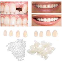 Temporary Tooth Repair Kit Thermal Molding Teeth Repair Replacement Fitting  Beads Denture Repair Fake Teeth Veneer for Filling Missing Broken Teeth